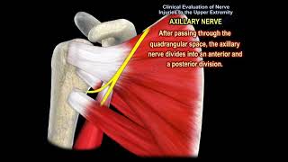 NERVE INJURY IN THE UPPER EXTREMITY Everything You Need To Know  Dr Nabil Ebraheim [upl. by Aisat]